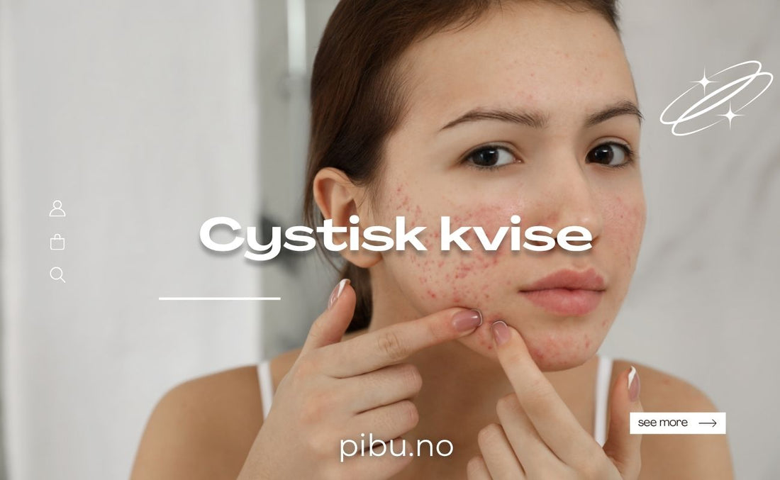 Cystic pimple