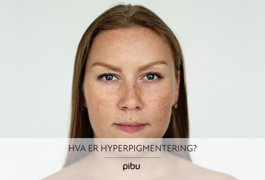 Hyperpigmentering: Årsaker, behandling og hvordan du får jevnere hudtone
