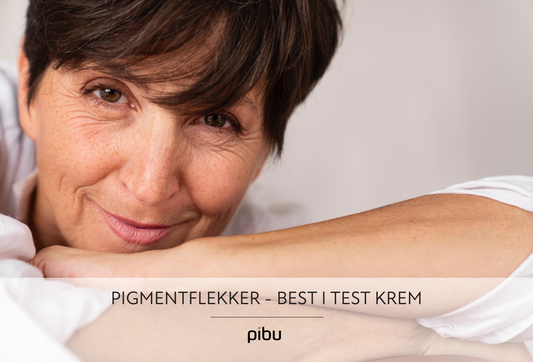 Best i test krem mot pigmentflekker