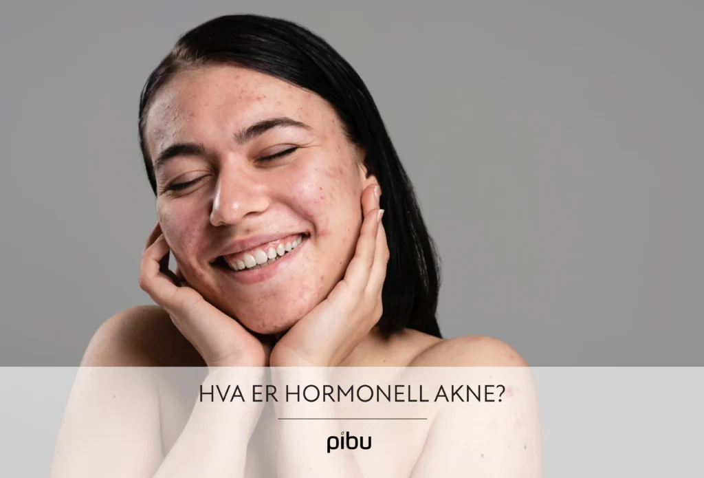 Hva er hormonell akne